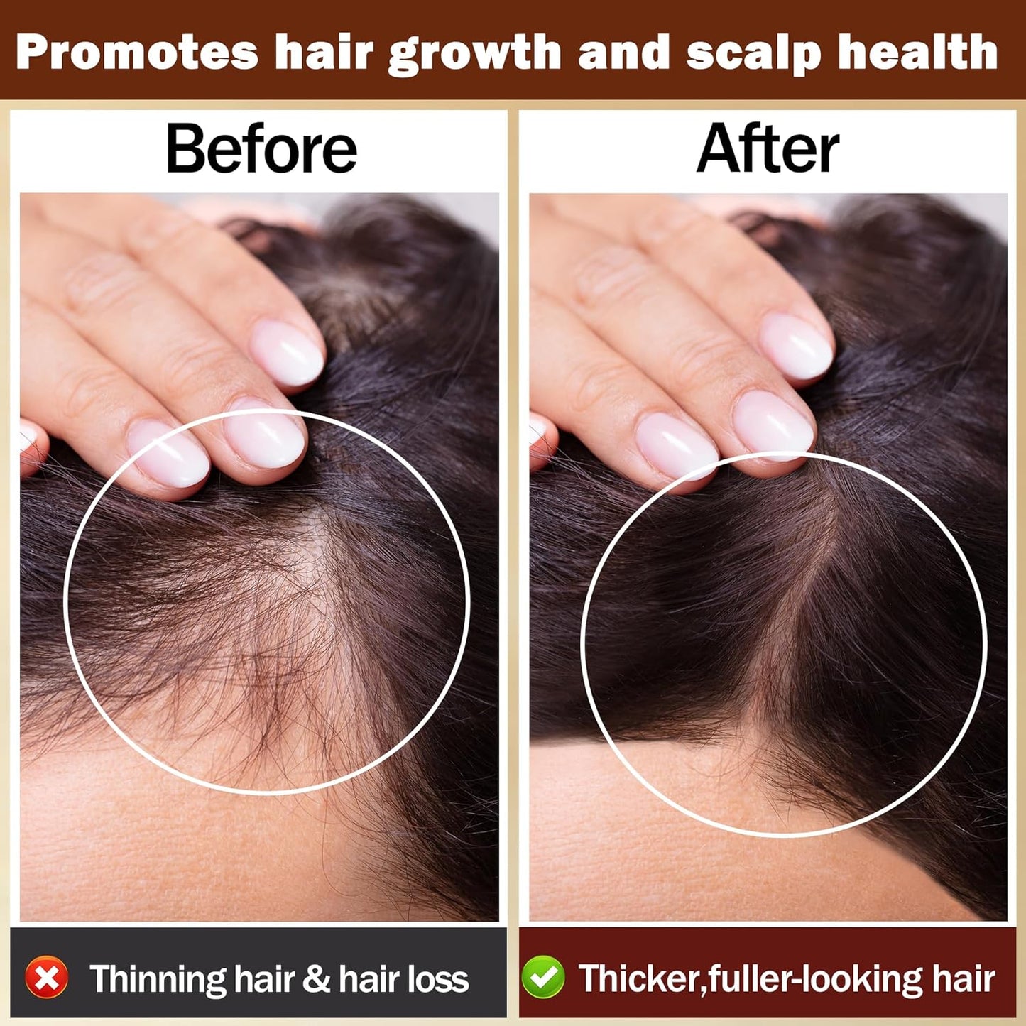 Rosemary Oil for Hair Growth,100% Pure & Natural Rosemary Essential Oil,Grapessed Oil for Skin & Hair Care & Eyelash Eyebrows Growth,Non-Greesy Hair Growth Oil/Serum Hair Loss Treatment for Women(2