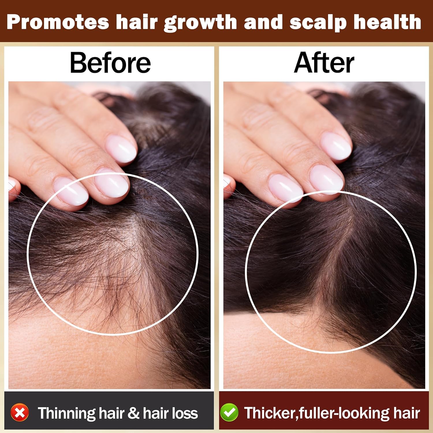 Rosemary Oil for Hair Growth,100% Pure & Natural Rosemary Essential Oil,Grapessed Oil for Skin & Hair Care & Eyelash Eyebrows Growth,Non-Greesy Hair Growth Oil/Serum Hair Loss Treatment for Women(2